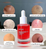 سرم آنوا نیاسینامید و ترانگزامیک اسید